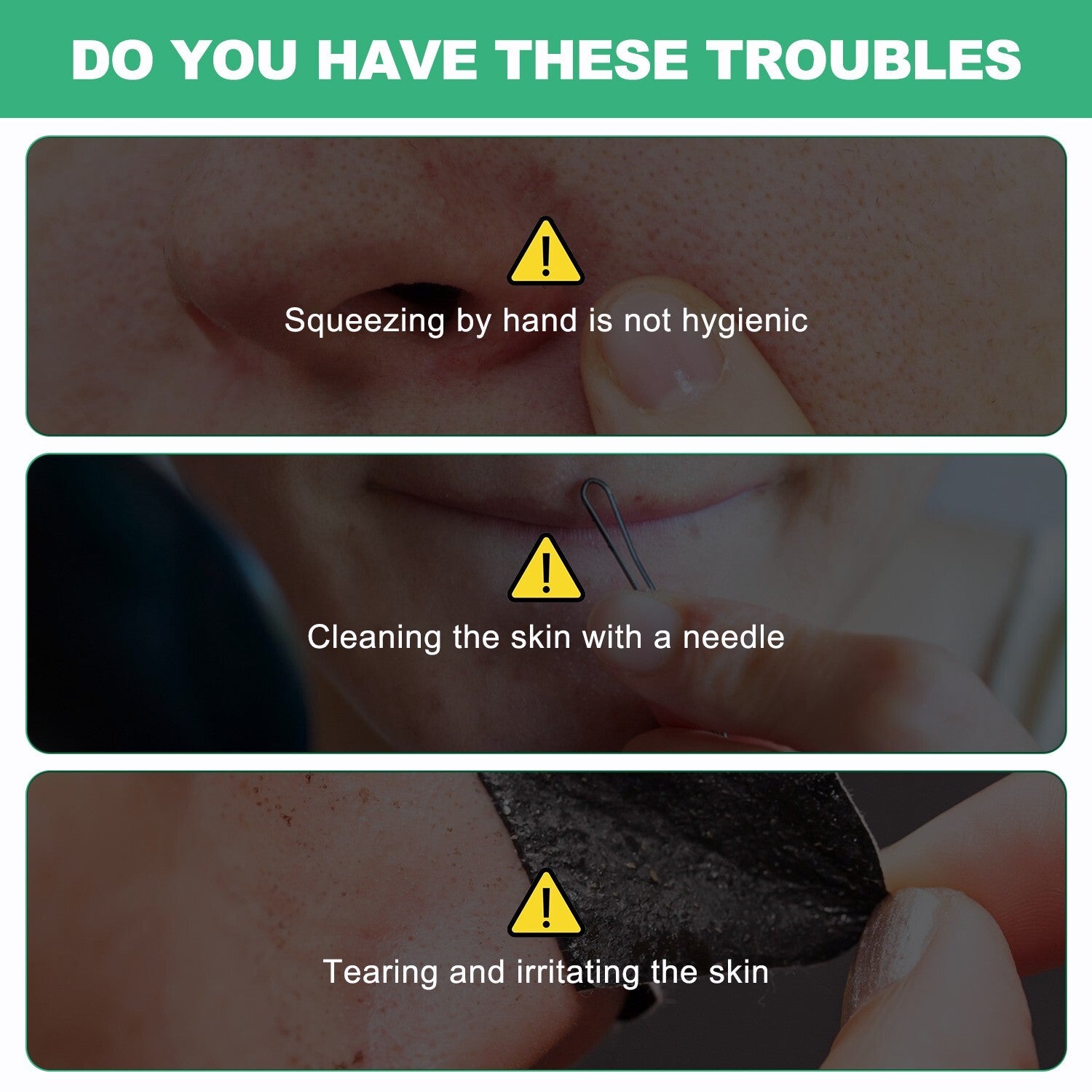 Acne Peel-Off Mask - Charcoal Facial Cleanser for Blackhead Removal & Clear Skin